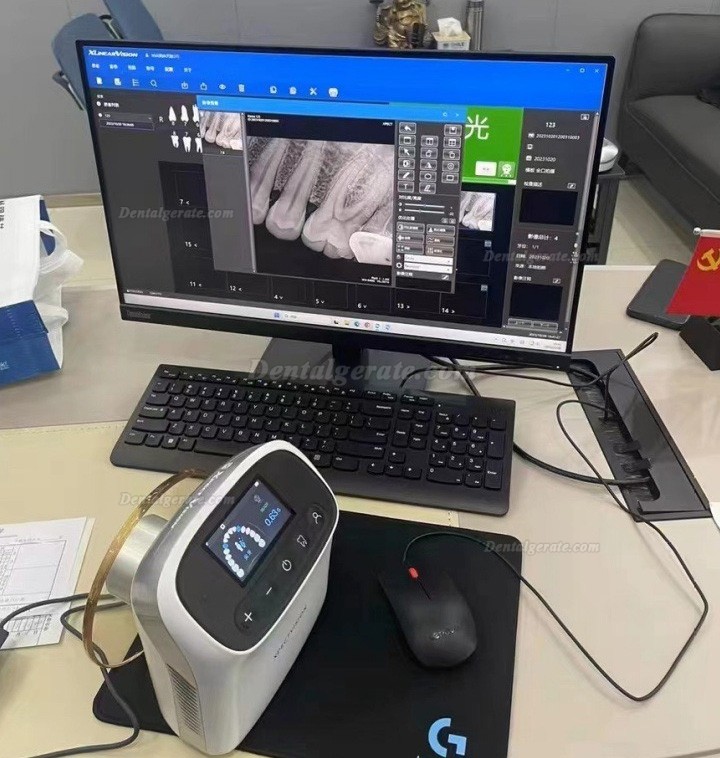 Handgehaltenes Dental R&ouml;ntgenger&auml;t, Mobile Hochfrequenz R&ouml;ntgenger&auml;t XVbeam2000